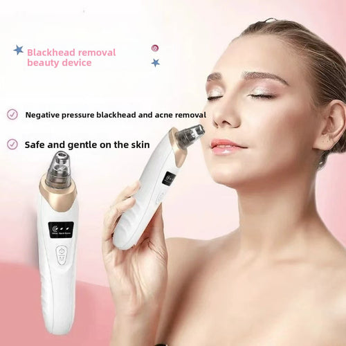 Rechargeable Blackhead Remover with 3 Suction Levels – White — QIUOLA | qiuola.com