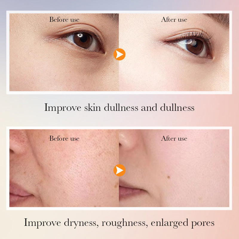 SADOER Vitamin C Facial Skincare Set, 6 Pieces — QIUOLA | qiuola.com
