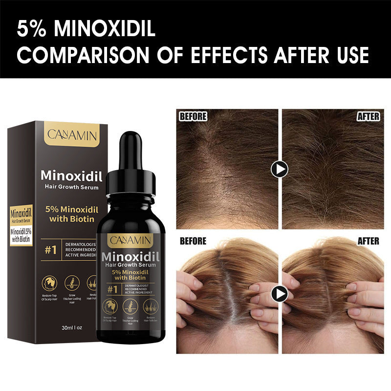 Topical Hair Essence, 30 ml — QIUOLA | qiuola.com